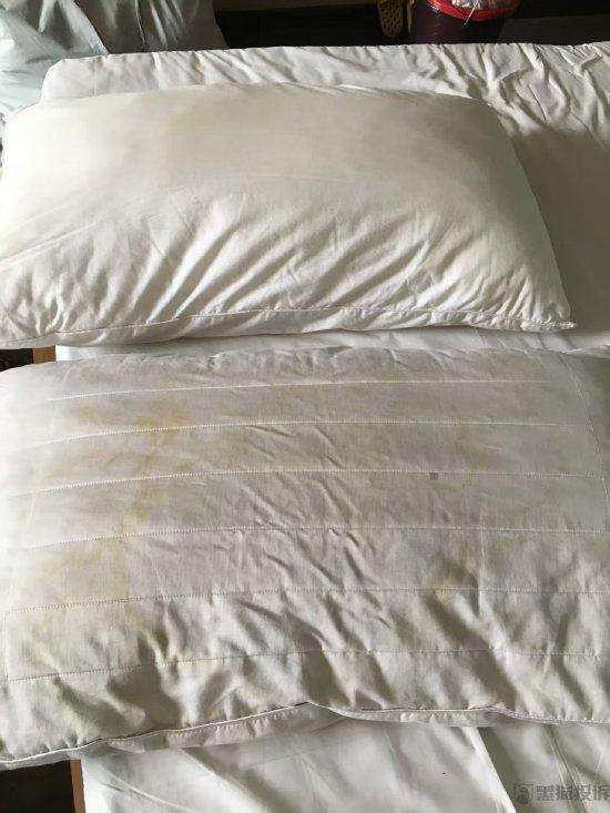  酒店卫生问题频发，消费者遭遇枕头污渍引发过敏；尚客优酒店处理态度引关注，换房需额外收费 新闻 酒店卫生问题频发，消费者遭遇枕头污渍引发过敏；尚客优酒店处理态度引关注，换房需额外收费 新闻 酒店卫生问题频发，消费者遭遇枕头污渍引发过敏；尚客优酒店处理态度引关注，换房需额外收费 新闻 酒店卫生问题频发，消费者遭遇枕头污渍引发过敏；尚客优酒店处理态度引关注，换房需额外收费 新闻 酒店卫生问题频发，消费者遭遇枕头污渍引发过敏；尚客优酒店处理态度引关注，换房需额外收费 新闻 酒店卫生问题频发，消费者遭遇枕头污渍引发过敏；尚客优酒店处理态度引关注，换房需额外收费 新闻 酒店卫生问题频发，消费者遭遇枕头污渍引发过敏；尚客优酒店处理态度引关注，换房需额外收费 新闻 酒店卫生问题频发，消费者遭遇枕头污渍引发过敏；尚客优酒店处理态度引关注，换房需额外收费 新闻 酒店卫生问题频发，消费者遭遇枕头污渍引发过敏；尚客优酒店处理态度引关注，换房需额外收费 新闻 酒店卫生问题频发，消费者遭遇枕头污渍引发过敏；尚客优酒店处理态度引关注，换房需额外收费 新闻 酒店卫生问题频发，消费者遭遇枕头污渍引发过敏；尚客优酒店处理态度引关注，换房需额外收费 新闻